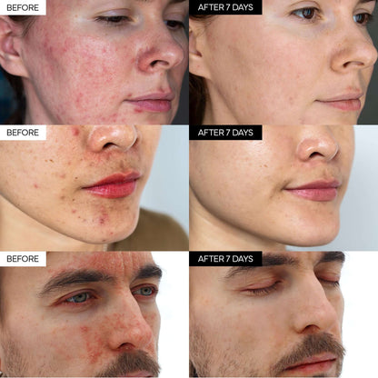 ✨Intensive Cica Repair Cream