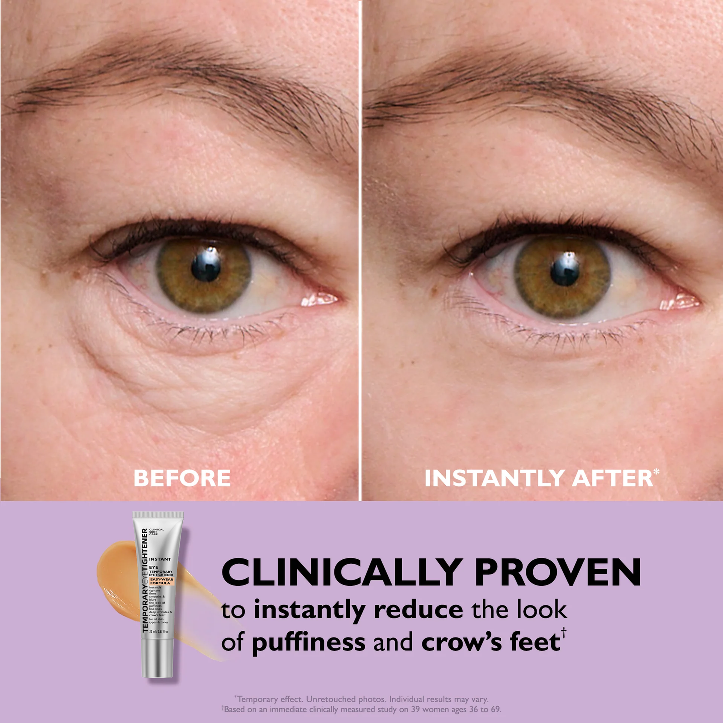 Last 3 Hours:🔥 Up to 15% OFF – Instant Eye Tightener Easy-Wear Formula