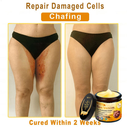 Dermatology Official: Natravor® Skin Treatment Cream Anti-aging, Hydrating, Skin Repair, Even Tone, Acne and Dark Spot Treatment, Wart and Mole Removal, Psoriasis Relief