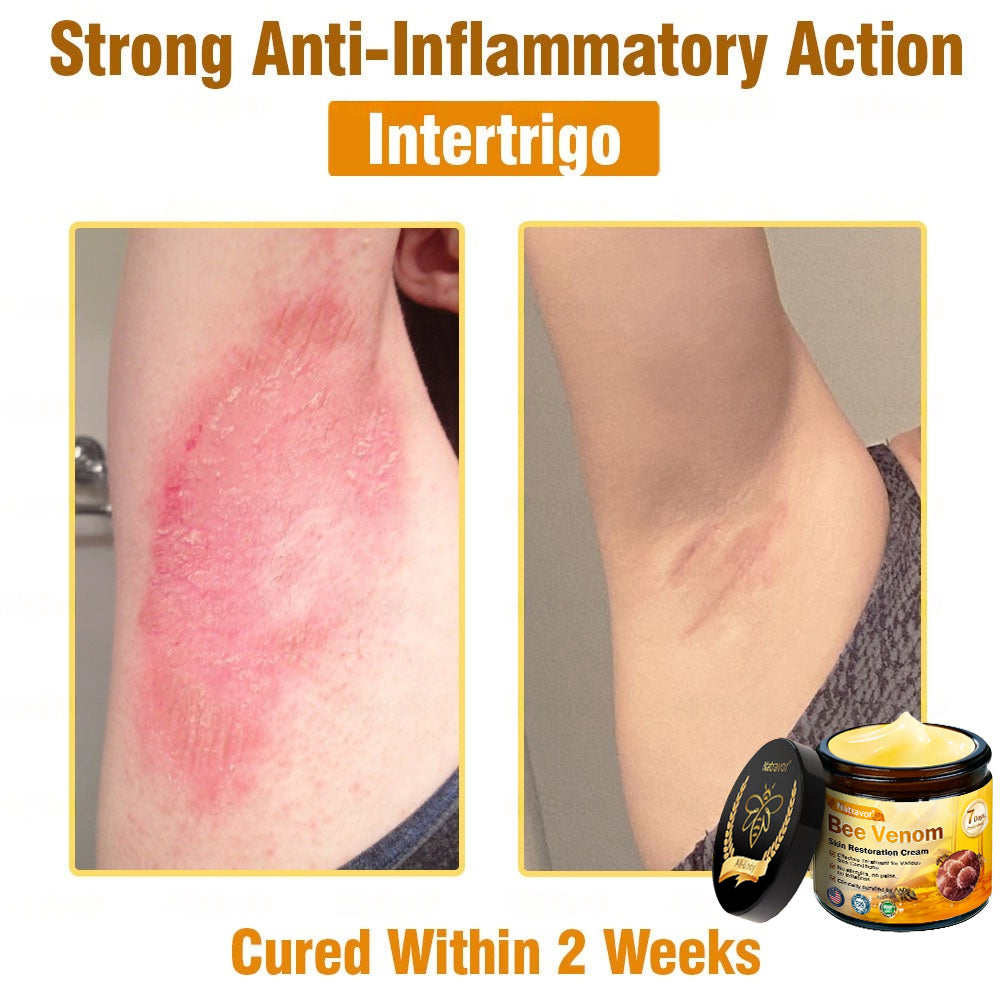 Dermatology Official: Natravor® Skin Treatment Cream Anti-aging, Hydrating, Skin Repair, Even Tone, Acne and Dark Spot Treatment, Wart and Mole Removal, Psoriasis Relief