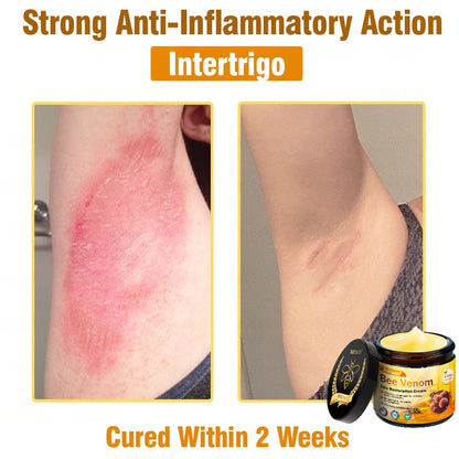 Dermatology Official: Natravor® Skin Treatment Cream Anti-aging, Hydrating, Skin Repair, Even Tone, Acne and Dark Spot Treatment, Wart and Mole Removal, Psoriasis Relief