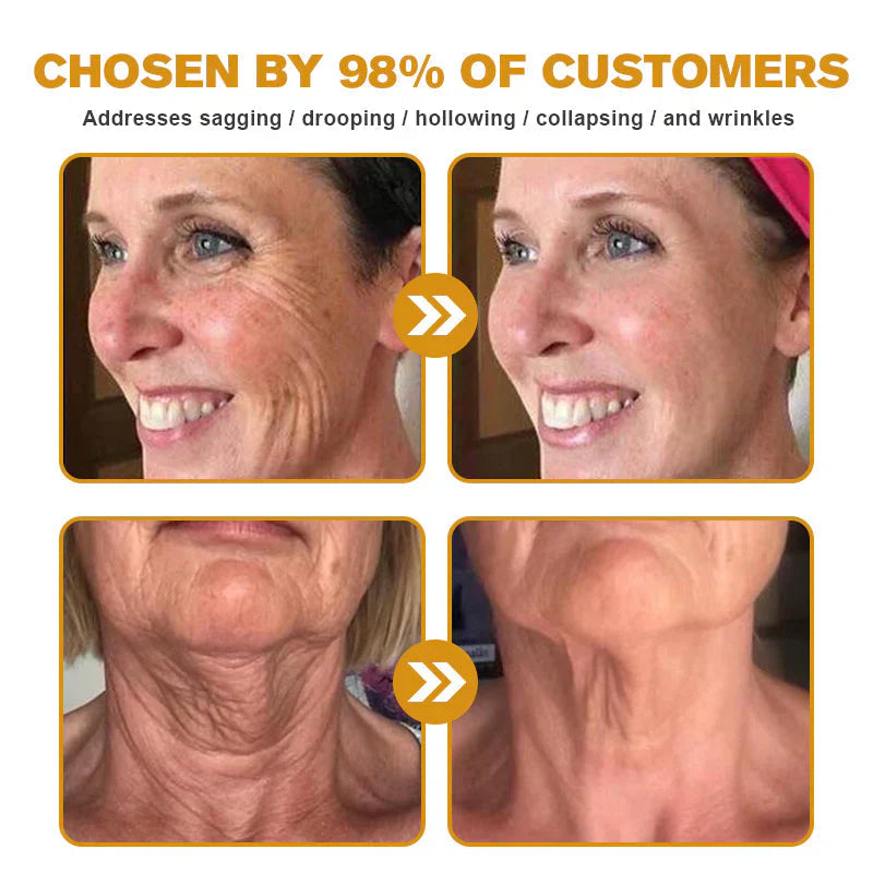 Dermatology Official: Natravor® Skin Treatment Cream Anti-aging, Hydrating, Skin Repair, Even Tone, Acne and Dark Spot Treatment, Wart and Mole Removal, Psoriasis Relief