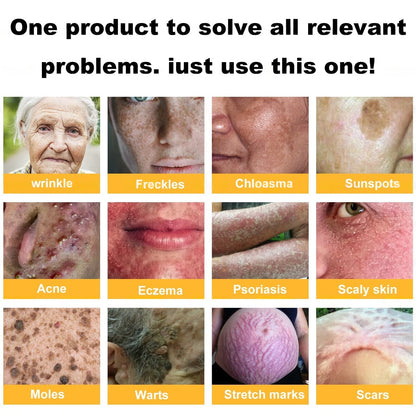 Dermatology Official: Natravor® Skin Treatment Cream Anti-aging, Hydrating, Skin Repair, Even Tone, Acne and Dark Spot Treatment, Wart and Mole Removal, Psoriasis Relief
