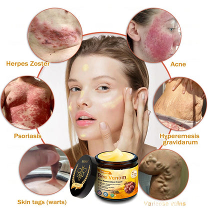 Dermatology Official: Natravor® Skin Treatment Cream Anti-aging, Hydrating, Skin Repair, Even Tone, Acne and Dark Spot Treatment, Wart and Mole Removal, Psoriasis Relief
