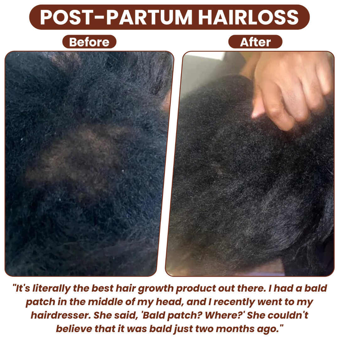 🔥Pure Batana Oil