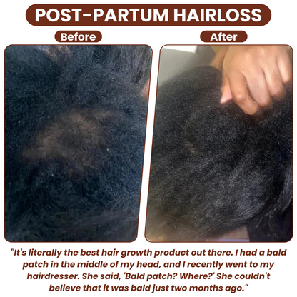 🔥Pure Batana Oil